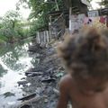 Falta de saneamento provocou mais de 340 mil internações em 2024