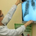 Brasil amplia prevenção e aposta em tratamentos inovadores para eliminar a tuberculose