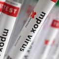 Região Norte do Brasil registra casos de mpox