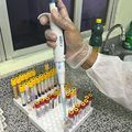 Lacen-PI recebe novos equipamentos para fortalecer a capacidade de diagnóstico