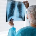 Pesquisa avalia impacto financeiro da Tuberculose em famílias piauienses
