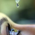 Oftalmologistas lançam campanha 24 Horas pelo Glaucoma